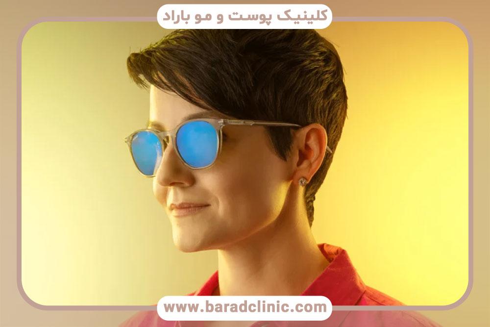 بلفاروپلاستی