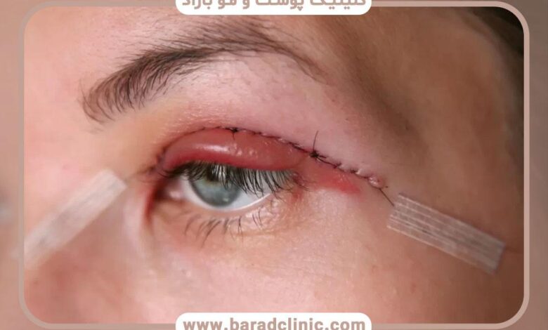 b97823a2 662d 45d2 907e e03d1b0b6636